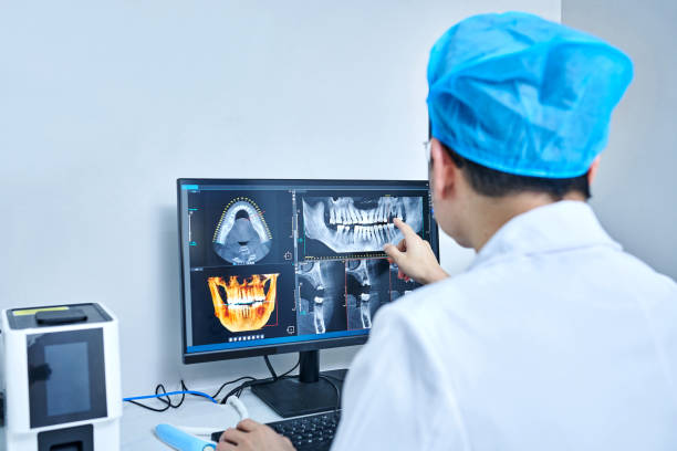 Best Emergency Wisdom Tooth Extraction in Coushatta, LA