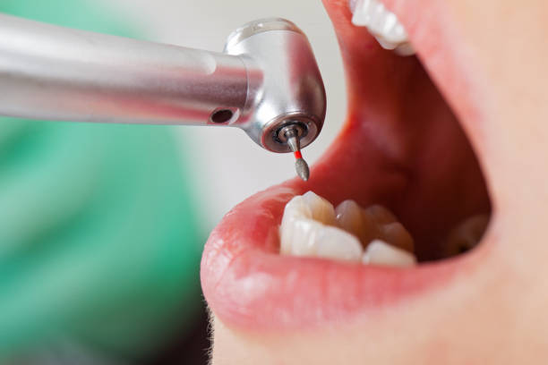 Best After-Hours Dental Care in Coushatta, LA